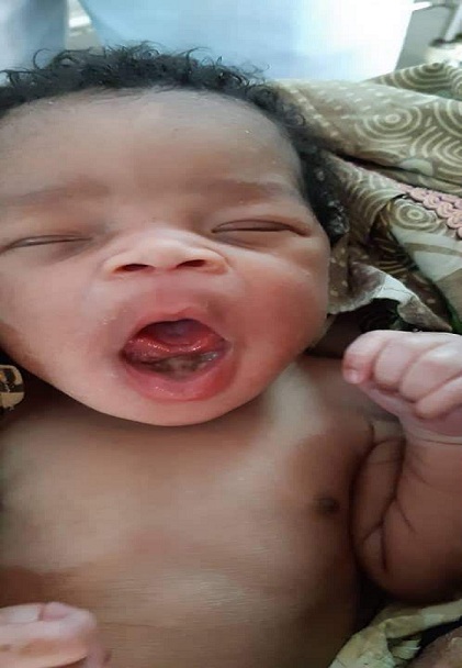 Doctores cubanos en Gambia mejoran calidad de vida de un bebé de 3&nbsp;años